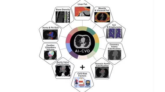 AI-CVD: AI analysis of heart, lungs, bone density, and cardiovascular risk factors from a single CT scan